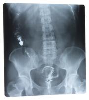 rentgen kręgosłup.jpg